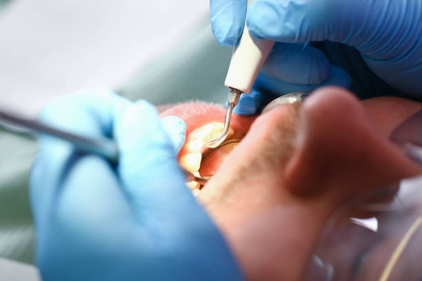 Best Urgent Care for Lost Fillings or Crowns in Centerville, GA