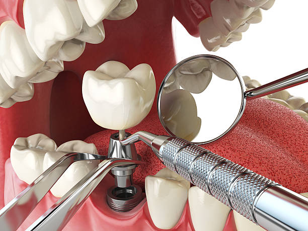 Best Pediatric Emergency Dentist in Centerville, GA