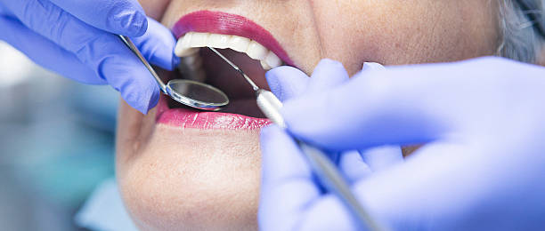 Best Emergency Treatment for Dental Infections or Abscesses in Centerville, GA